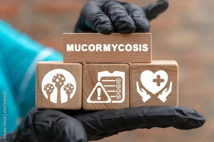 Mucormycosis Symptoms Explained